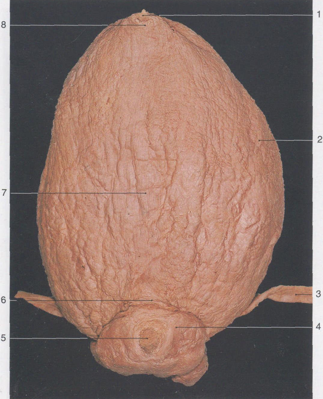图1-66 子宫和膀胱的位置(超声图)-泌尿科学-医学